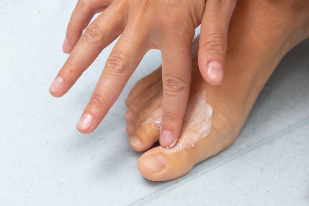 Aplicación de crema Demyxil del hongo entre los dedos de los pies